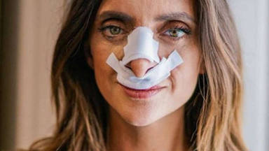 El sorprendente resultado del "agrandamiento" de nariz de Macarena Gómez que se ha convertido en viral