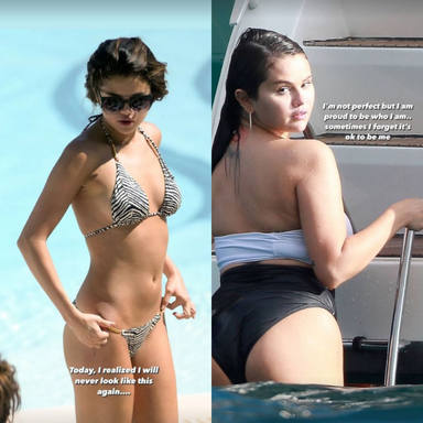 Selena Gomez's physical change